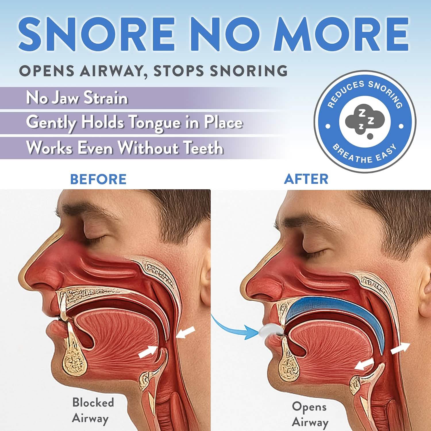 This diagram shows how the Good Morning Snore Solution helps reduce snoring.
