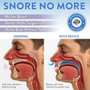 "Snore No More" infographic comparing an obstructed snoring airway to a clear airway using the anti-snoring device.