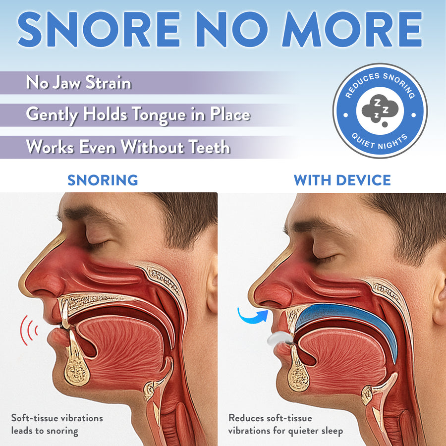 "Snore No More" infographic comparing an obstructed snoring airway to a clear airway using the anti-snoring device.