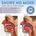 This diagram shows how the Good Morning Snore Solution helps reduce snoring.