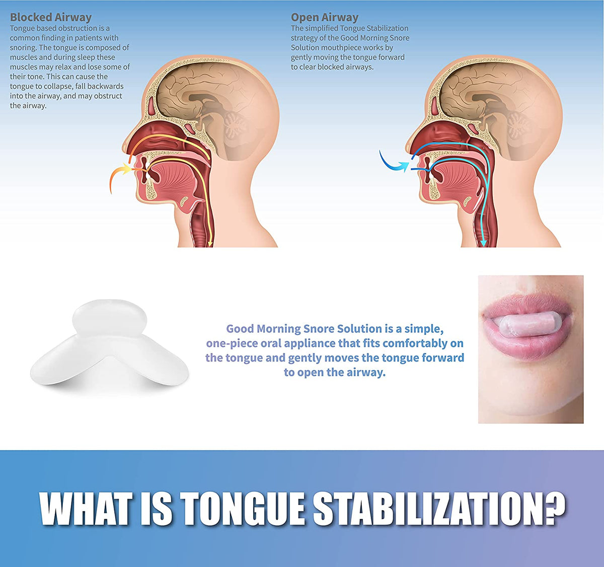 Mouthpiece diagram shown, blocked airway and opened airway and how mouthpiece can resolve issue