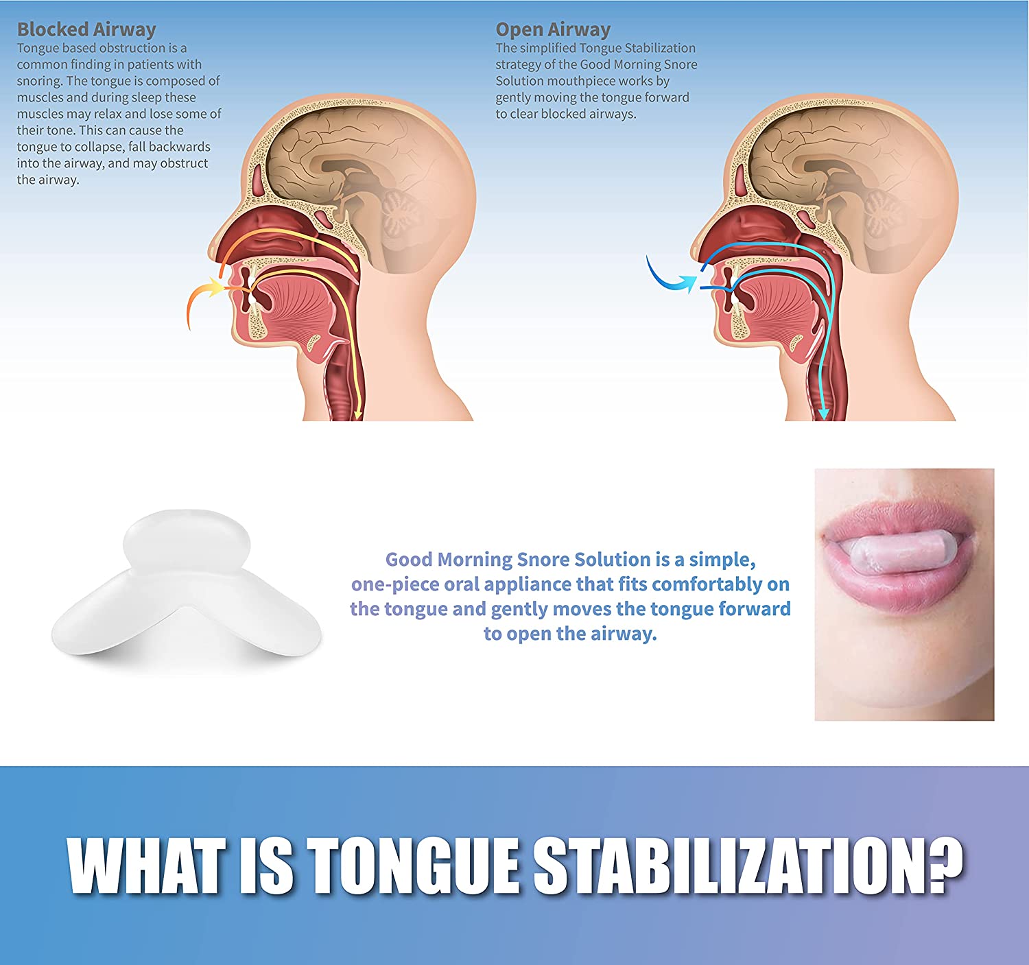 diagram displaying blocked airway vs opened airway and how the mouthpiece can help